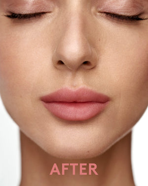 ערכת ליפ קיט נטע - אחרי