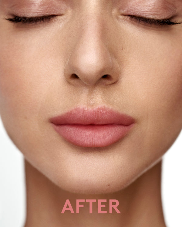 ערכת ליפ קיט נטע - אחרי