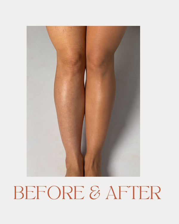 מייקאפ לגוף ולרגליים - תוצאות לפני / אחרי